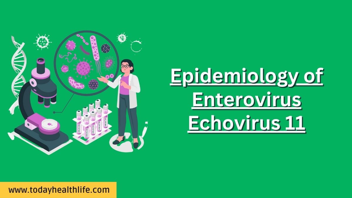 Epidemiology of Enterovirus Echovirus 11